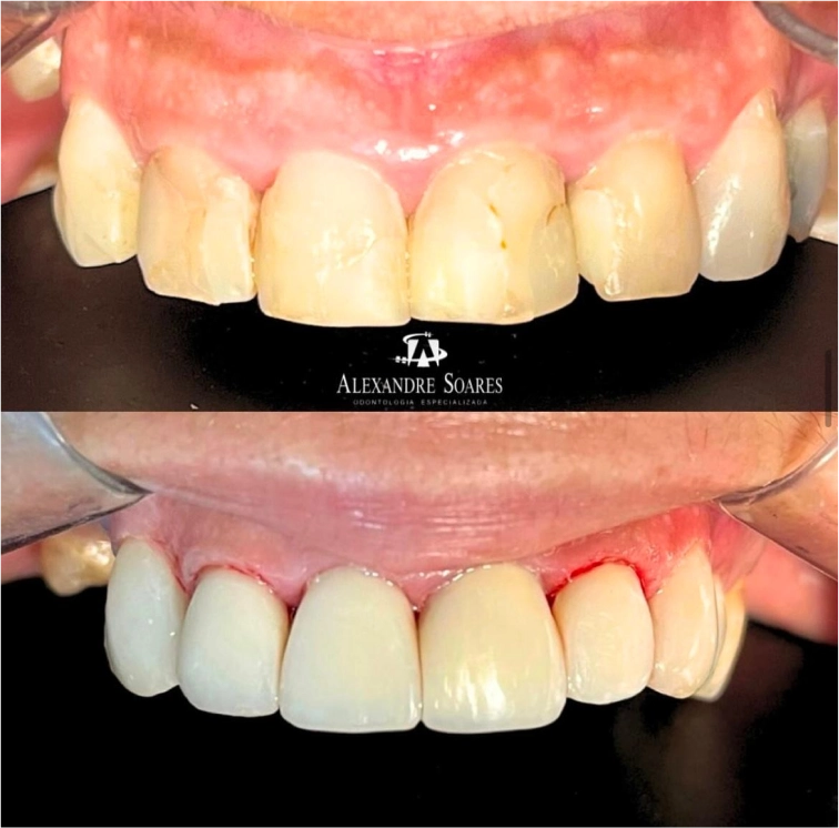 depoimento-dr-alexandre-01