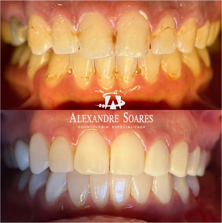 depoimento-dr-alexandre-02