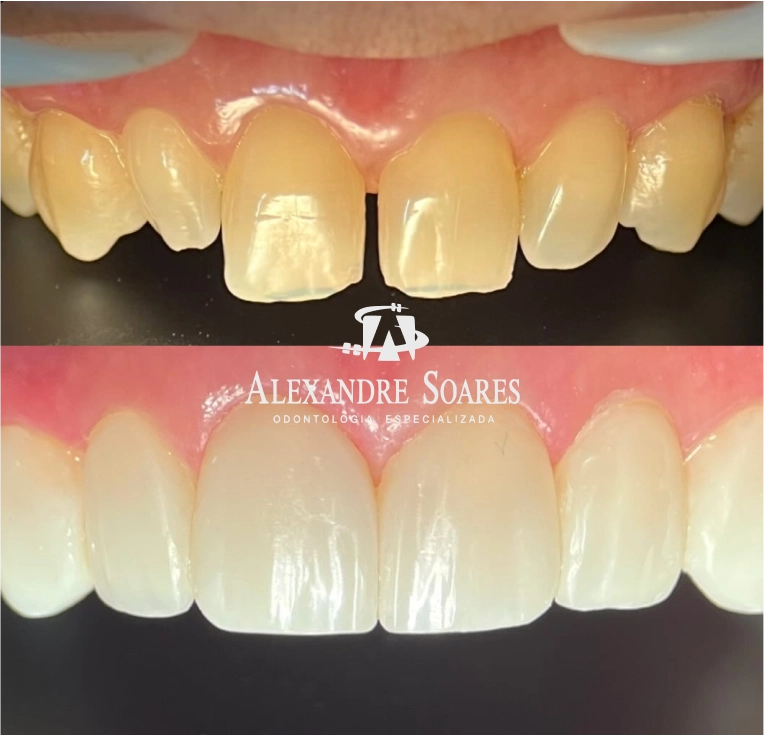 depoimento-dr-alexandre-03