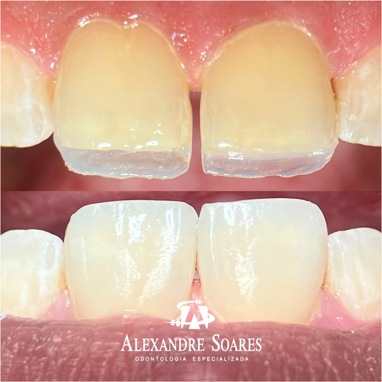 depoimento-dr-alexandre-04