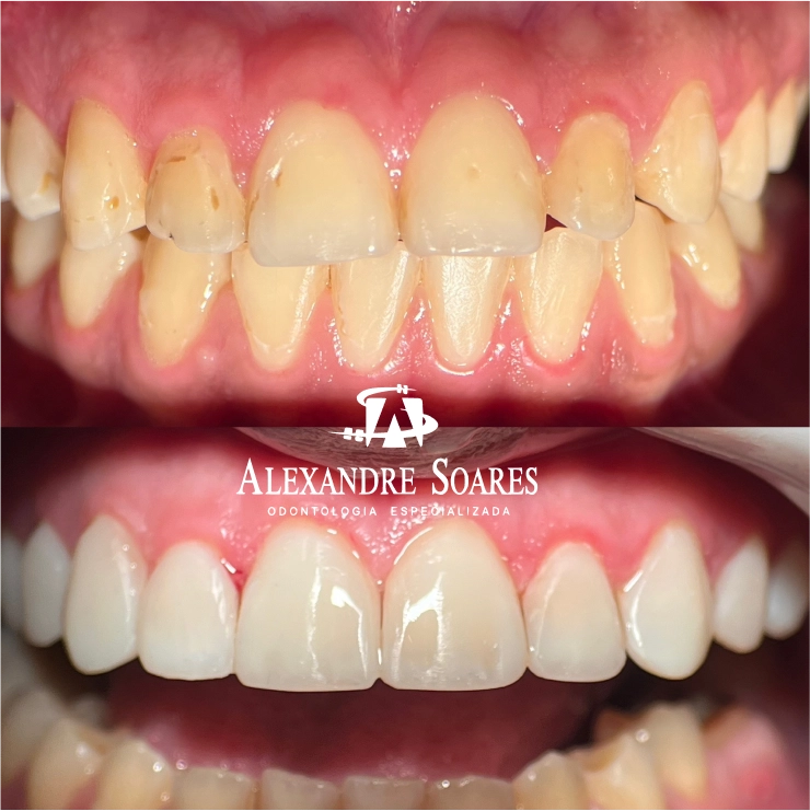 depoimento-dr-alexandre-05