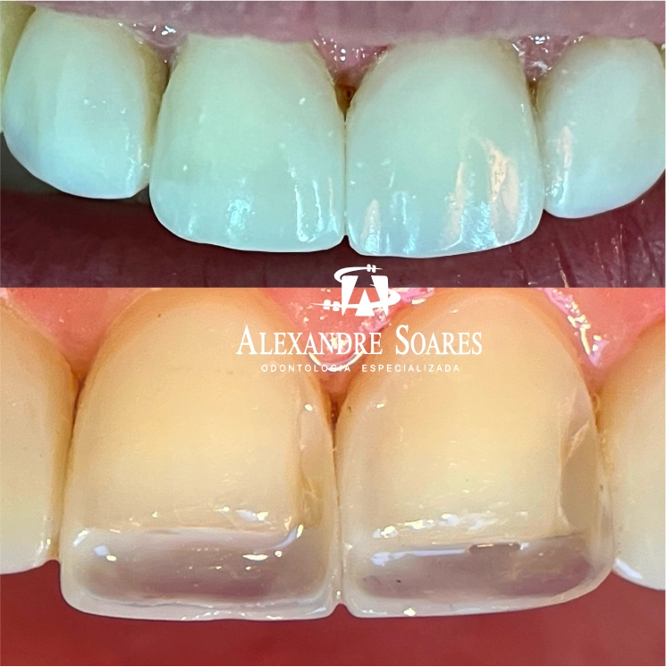 depoimento-dr-alexandre-06