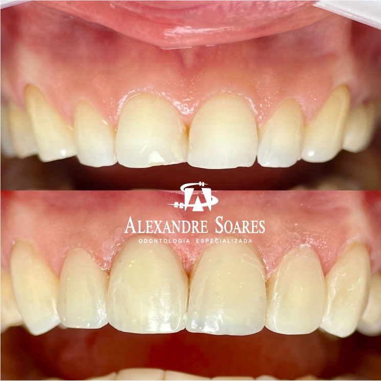 depoimento-dr-alexandre-07