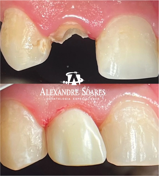 depoimento-dr-alexandre-08