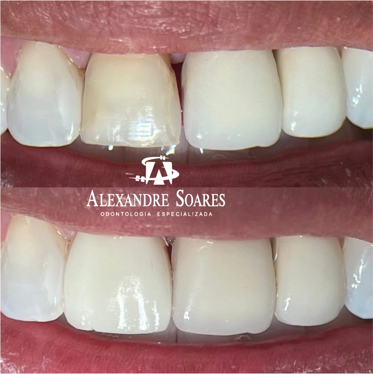 depoimento-dr-alexandre-10