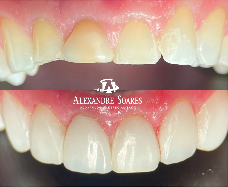 depoimento-dr-alexandre-11