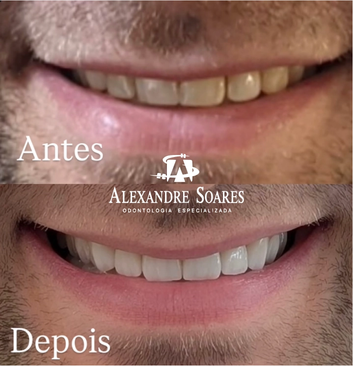 depoimento-dr-alexandre-12